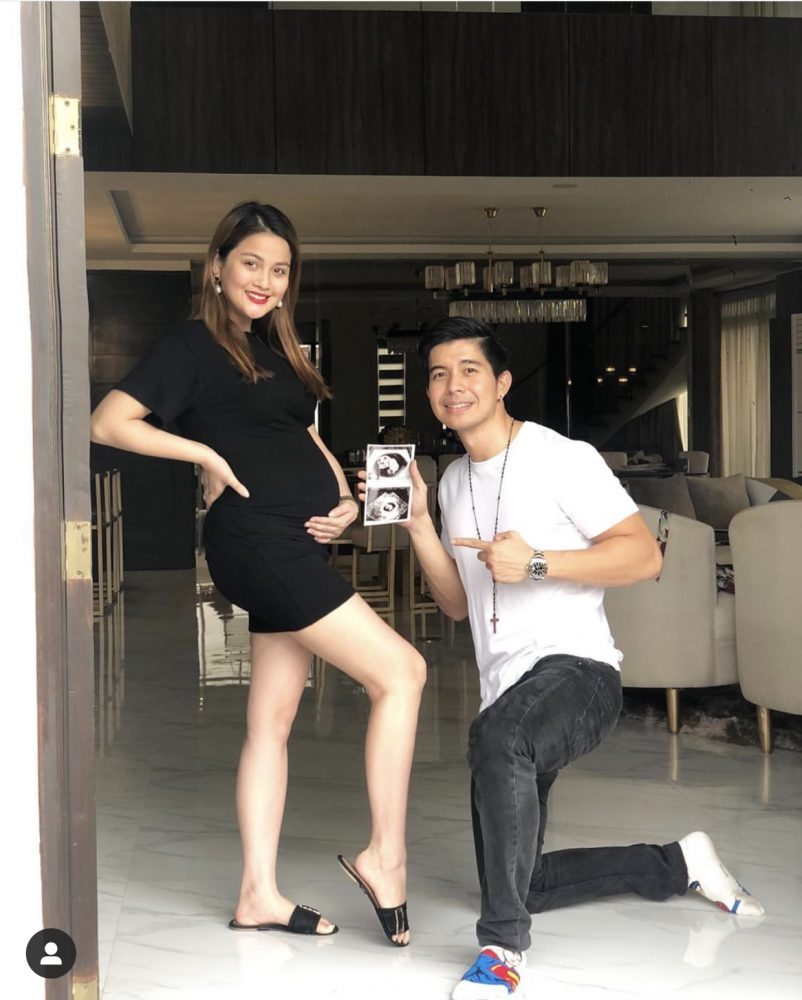 Rodjun Cruz at Dianne Medina, magkakababy na!